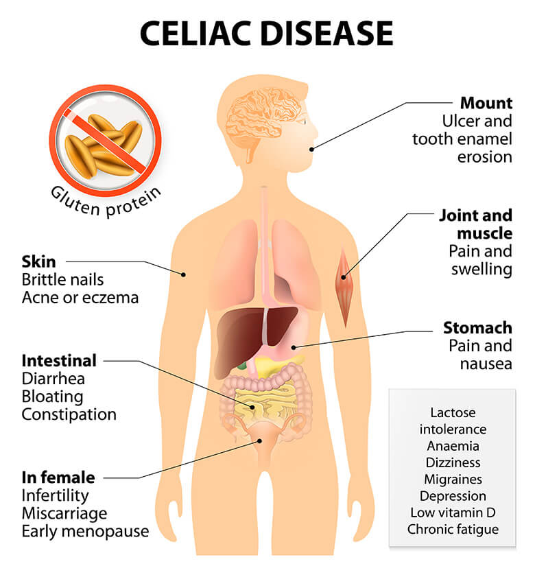 is-gluten-really-bad-for-you-healthy-hints